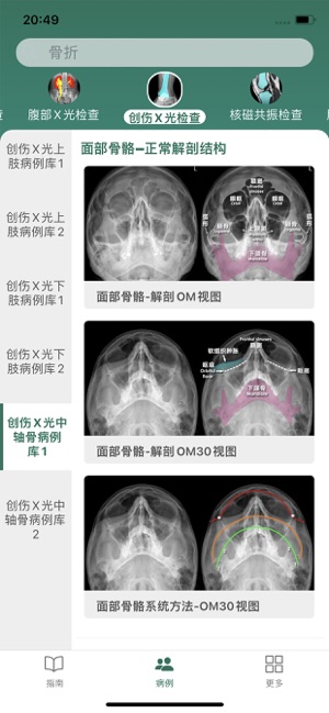 影像圖譜iPhone版截圖3