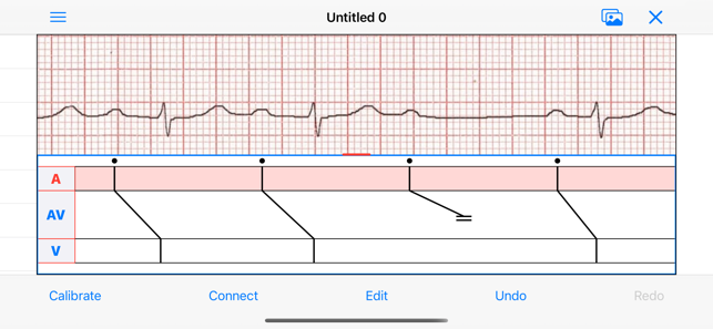 EPDiagramiPhone版截圖1